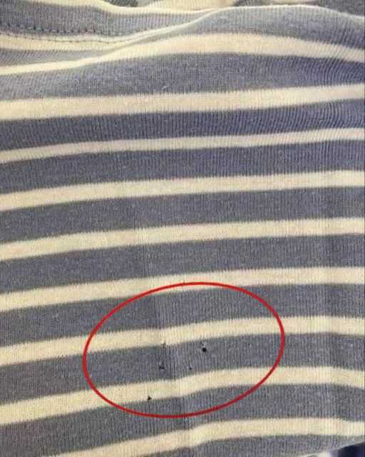 If You Spot These Holes in Your Clothes, Here’s What You Need to Know!