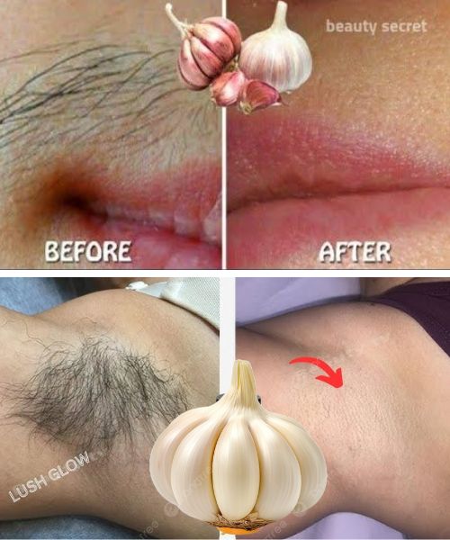 Stop Shaving! Here’s How to Permanently Get Rid of Facial, Body, and Pubic Hair with Garlic