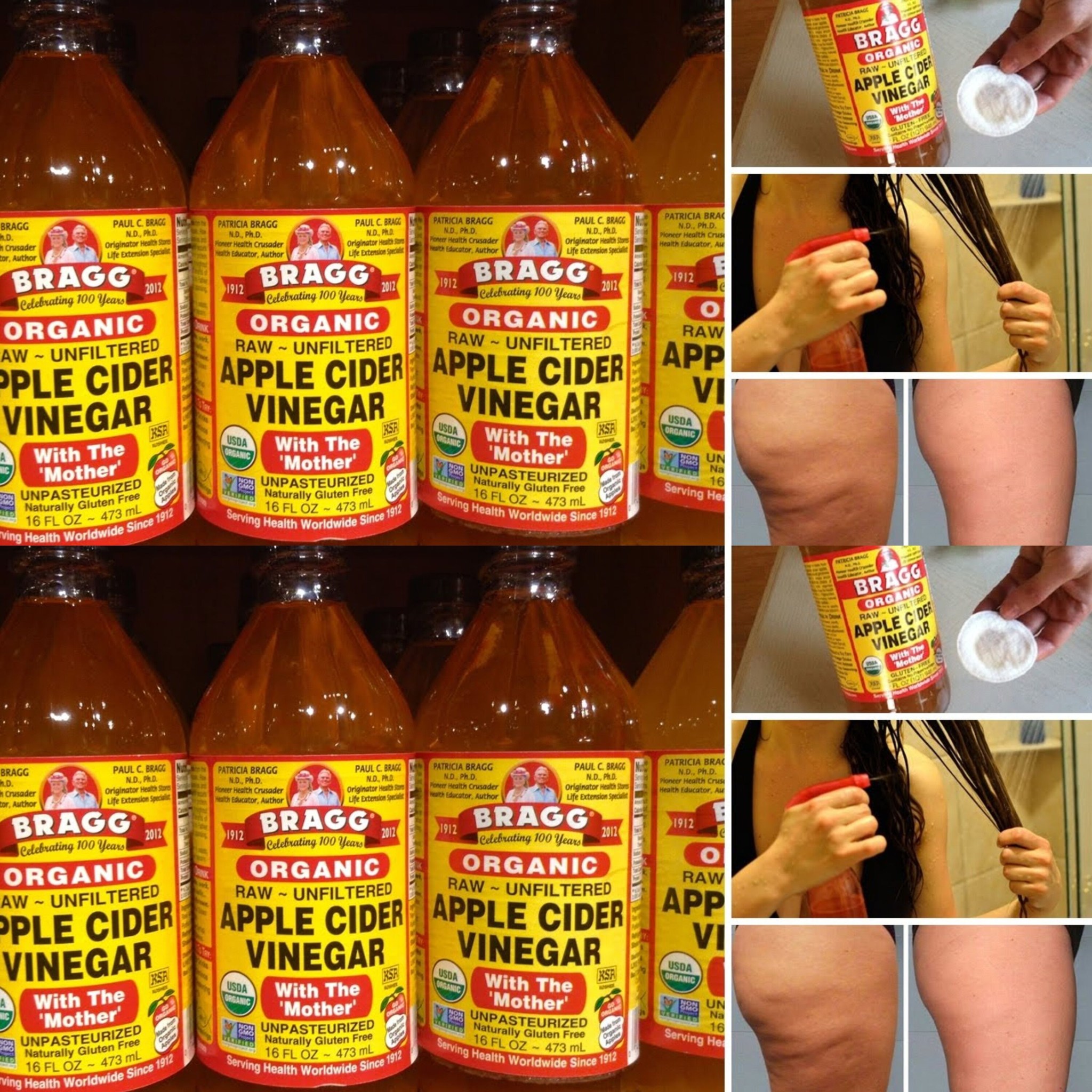 7 Surprising Beauty Benefits of Apple Cider Vinegar