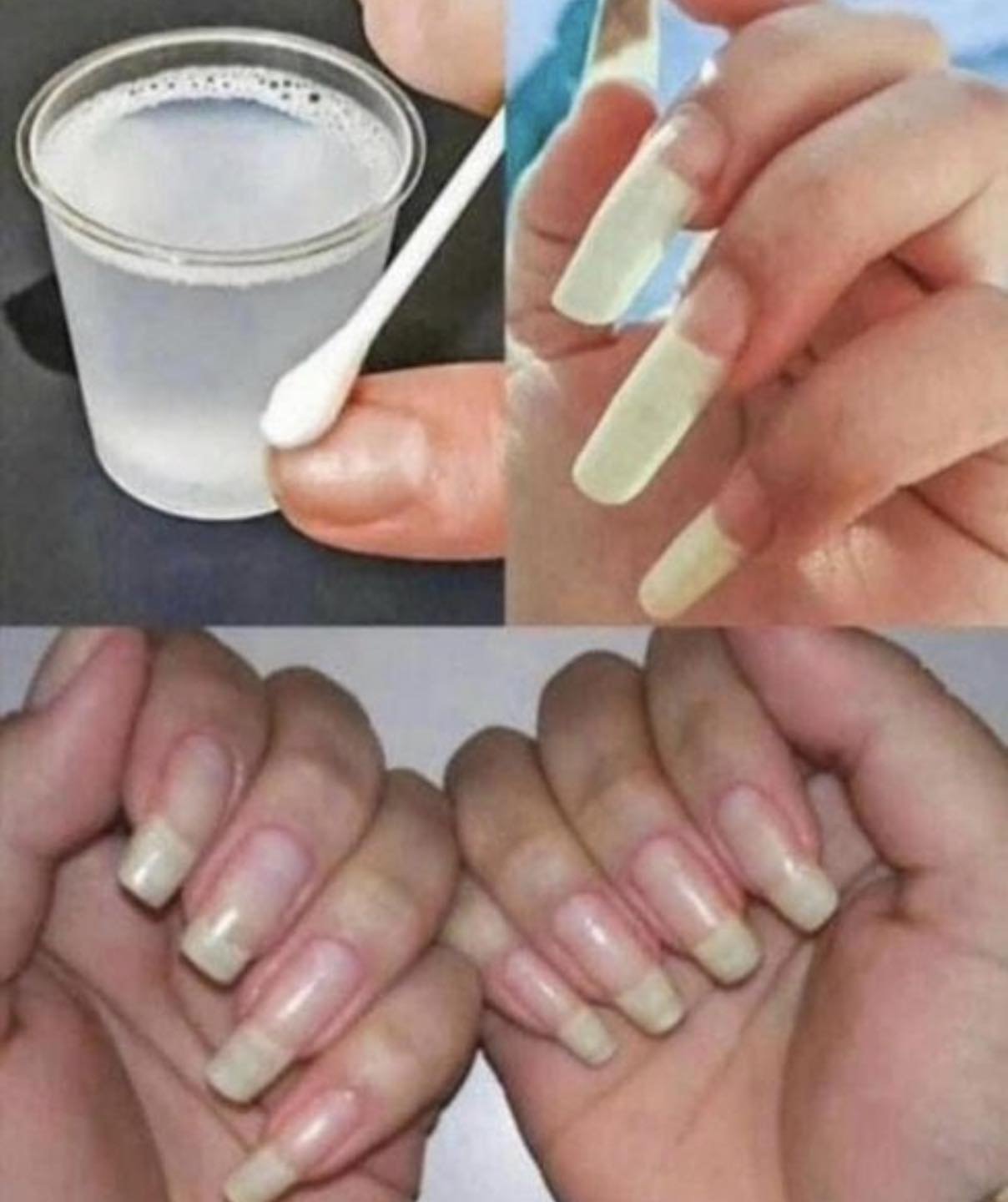 Remove fungus from your nails with one swipe and make them grow