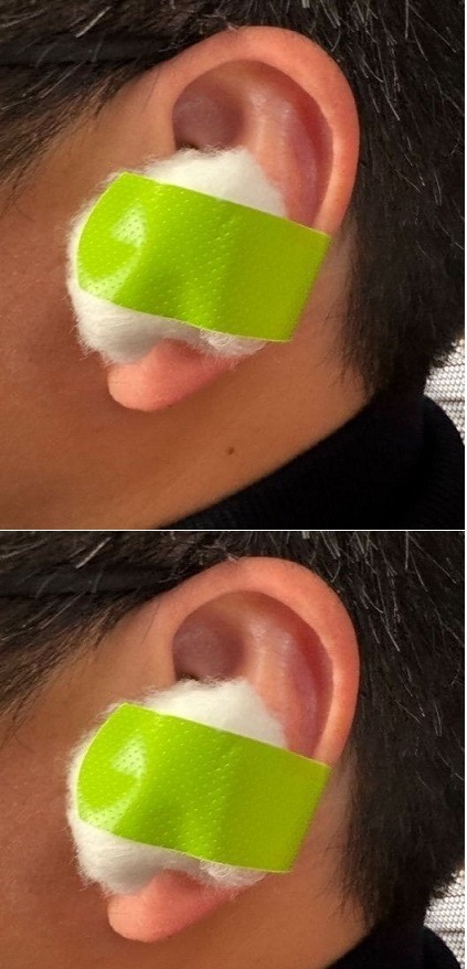 Place a cotton ball with VapoRub in your ear to experience a great effect.