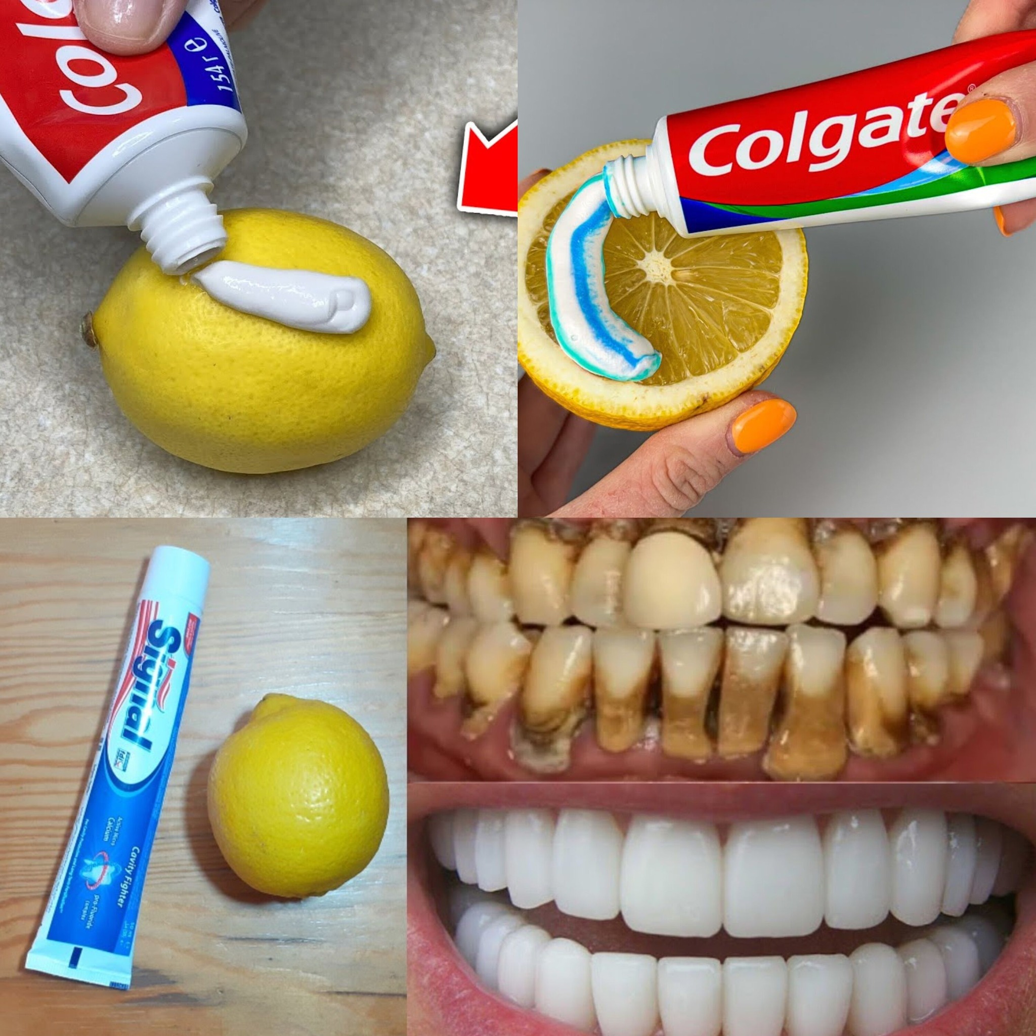 Natural mixture for yellow teeth whitening at home