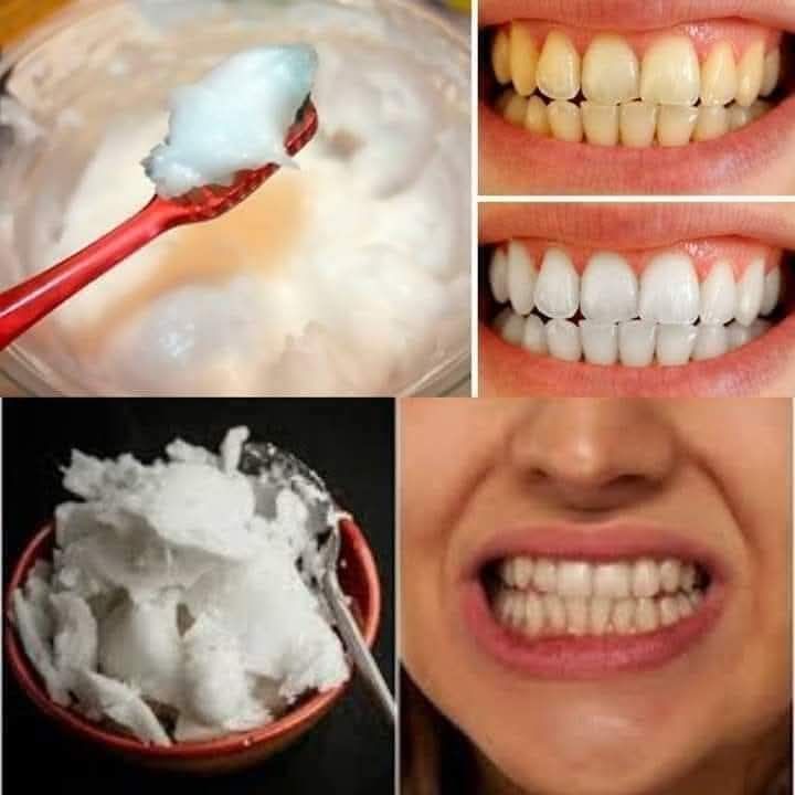 How to Naturally Whiten Your Teeth at Home In 3 Minutes