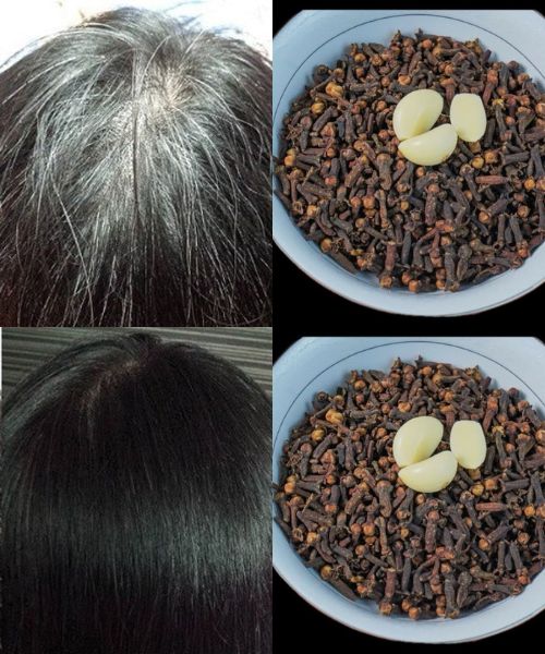 Restore Your Natural Hair Color with Garlic and Clove: A Natural Solution