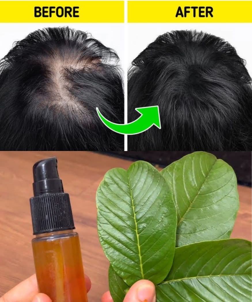 Put Guava Leaves in Your Shampoo and Watch Your Hair Grow Even on Your Forehead!Put Guava Leaves in Your Shampoo and Watch Your Hair Grow Even on Your Forehead!