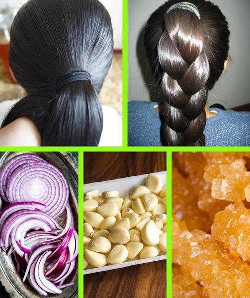 Garlic and onion: a magic recipe for hair growthGarlic and onion: a magic recipe for hair growth