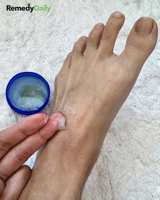 Lady rubs Vicks Vaporub on her feet before she sleeps for this brilliant reason