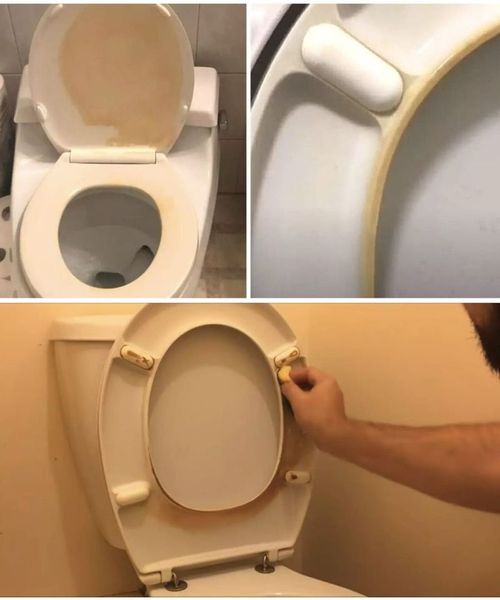 Causes of yellow stains on the toilet seat and in the toilet itself