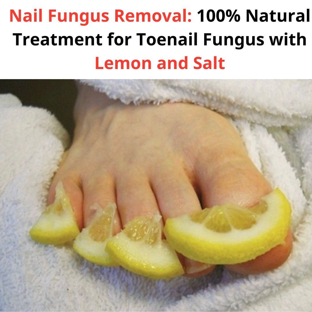 Eliminate nail fungus: Effectively treat toenail fungus with 100% natural lemon and salt