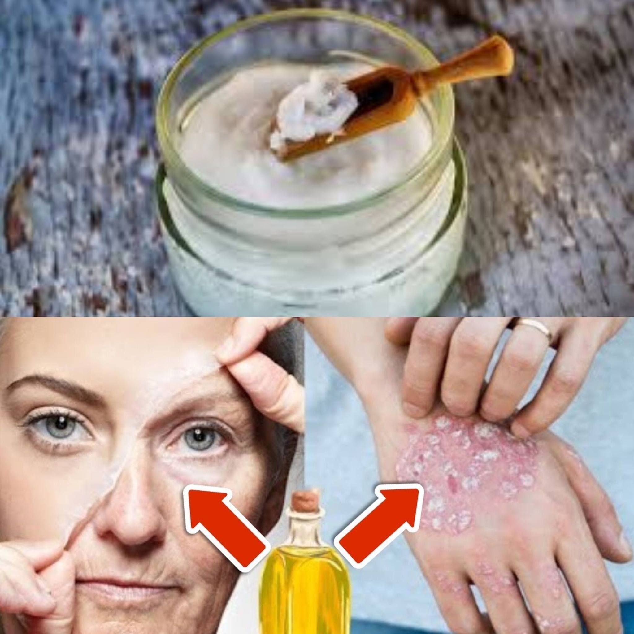 One drop of this oil removes wrinkles & psoriasis