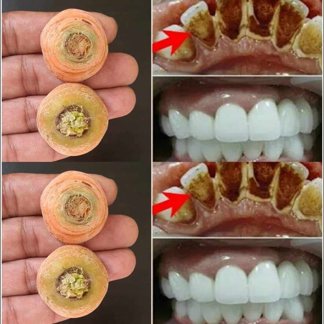 Improve Your Smile Naturally with Carrot Ends: An Easy Home Solution for Whiter Teeth