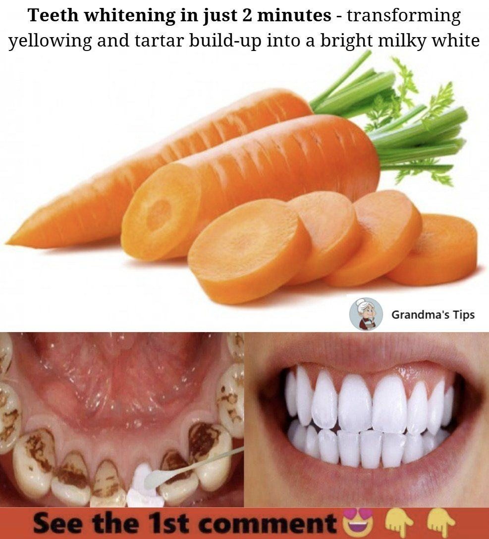 Teeth Whitening in Just 2 Minutes – Turn Yellowing and Tartar Buildup into Shiny Milky White with Carrot Tops!