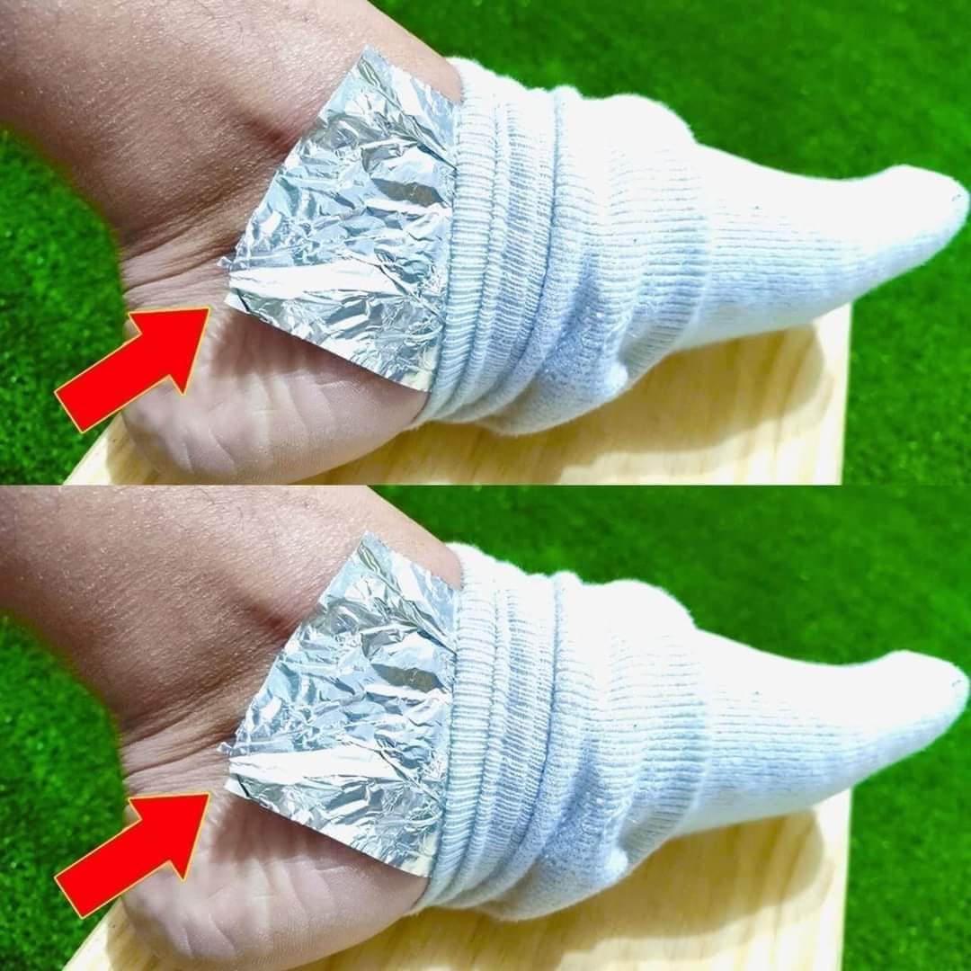 Put Aluminum Foil on Your Feet and Stop Spending Money at the Pharmacy: The Surprising Hack