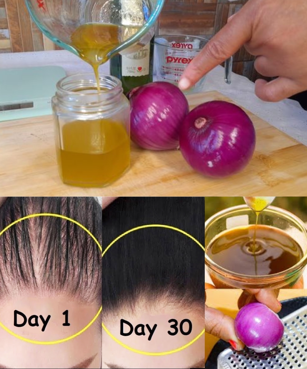 How to make onion hair oil for faster hair growth and stop hair fall