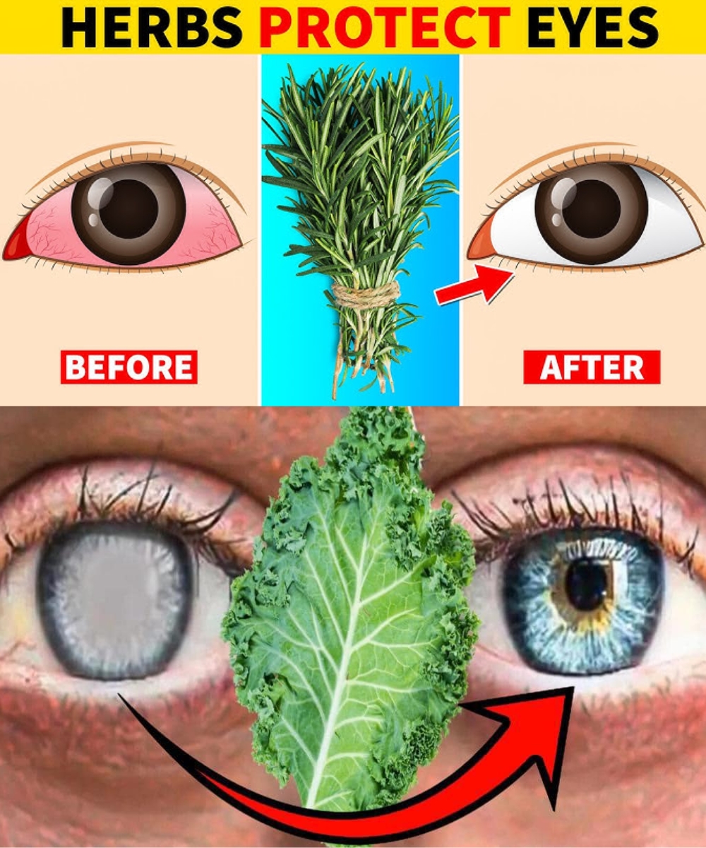 5 Essential Leaves to Naturally Improve Your Eye Health… See more