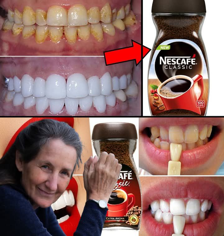 2-Minute Natural Teeth Whitening with Instant Coffee